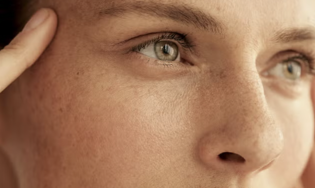 Експерти пояснюють, чому біостимулятор колагену став новою зіркою естетичної медицини